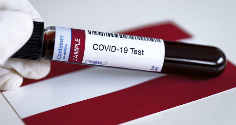 2020 03 21 seahelp news oesterreich covid 19 test quarantaene 750x422 1