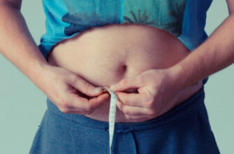 obezitate supraponderal 50992700