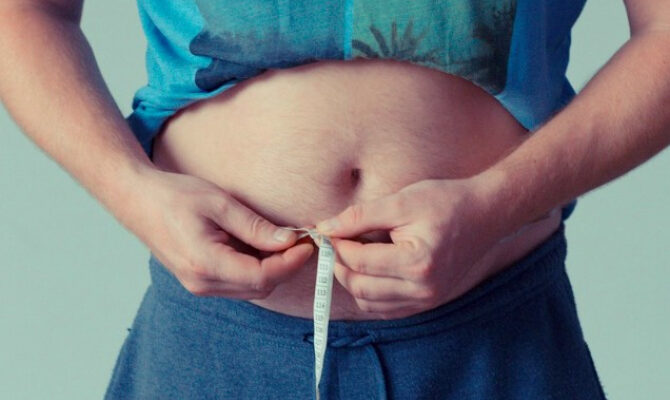 obezitate supraponderal 50992700