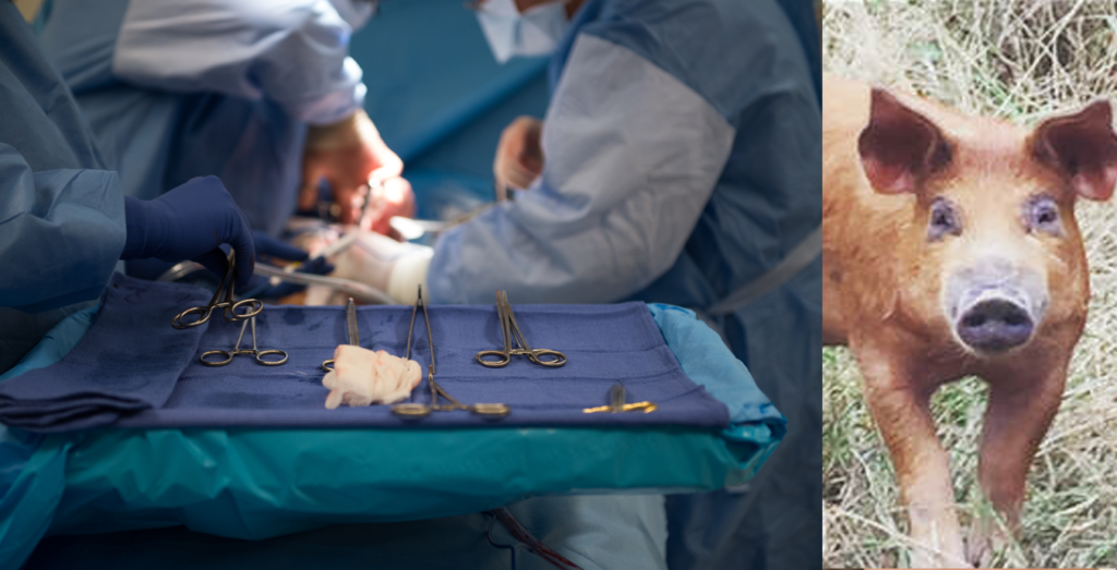 porc transplant medicina premiera rinichi