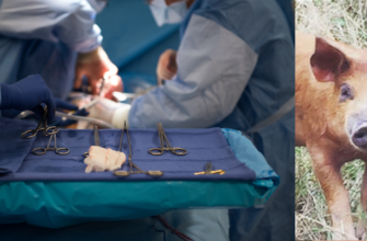 porc transplant medicina premiera rinichi