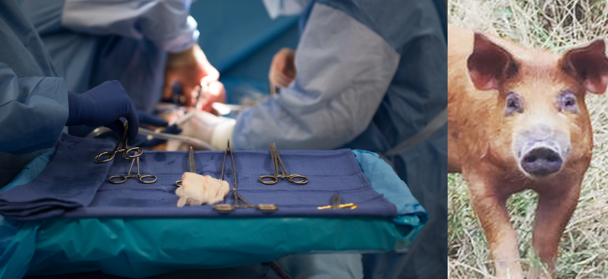 porc transplant medicina premiera rinichi