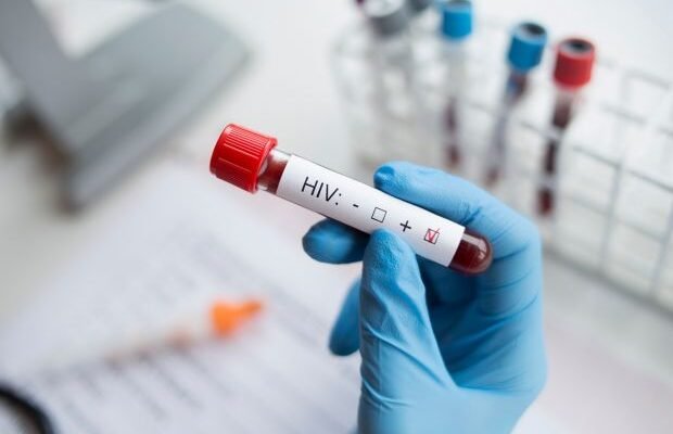 Caz extrem de rar. Medicii au descoperit a doua persoană din istorie care s-a vindecat natural de HIV