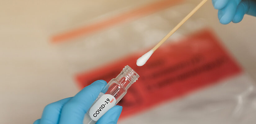 in chisinau va fi deschis un laborator pentru testare pcr