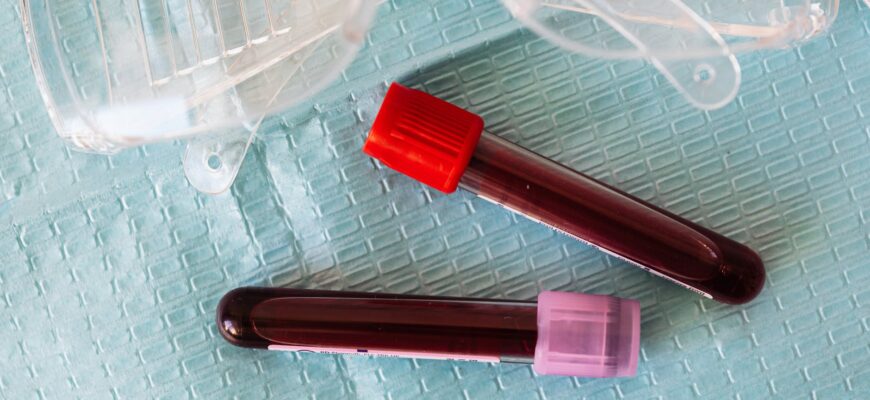 medical eyeglasses and full of blood vials on diaper