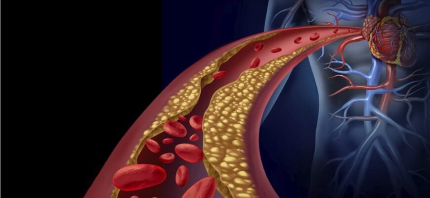 istock 000042241890 large 990x626 1