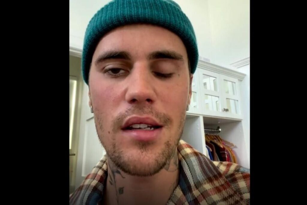 paralizia faciala a lui justin bieber 42191500