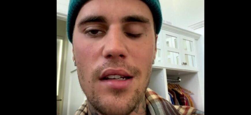 paralizia faciala a lui justin bieber 42191500