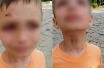 Doi copii au fost bătuți de un polițist de frontieră, la Basarabeasca. Procurorii au pornit un dosar penal