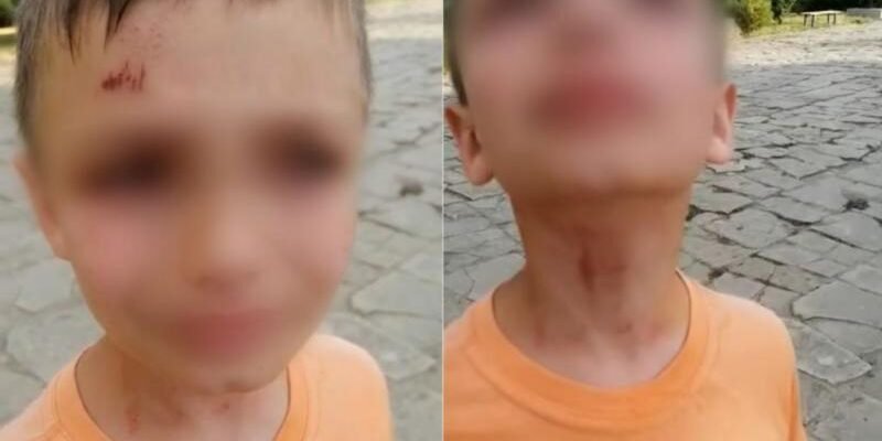 Doi copii au fost bătuți de un polițist de frontieră, la Basarabeasca. Procurorii au pornit un dosar penal
