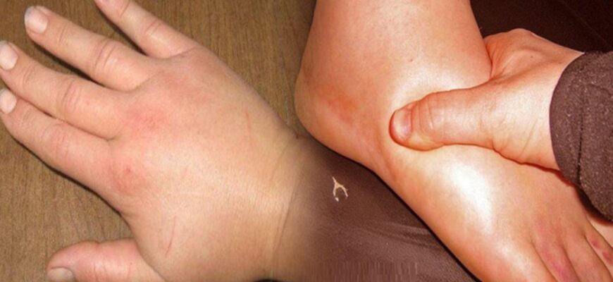 retentie de apa mare