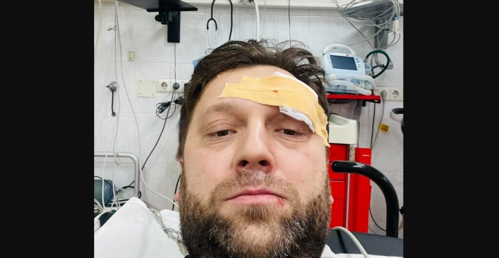 FOTO// Ministrul Economiei, Dumitru Alaiba, s-a pălit la cap: ”Am ajuns în grija medicilor” 2 FOTO// Ministrul Economiei, Dumitru Alaiba, s-a pălit la cap: ”Am ajuns în grija medicilor”