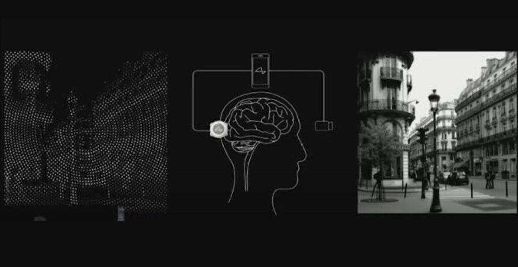 BLOOMBERG// Compania Neuralink: Musk speră să implanteze primul microcip în creierul uman în maximum șase luni