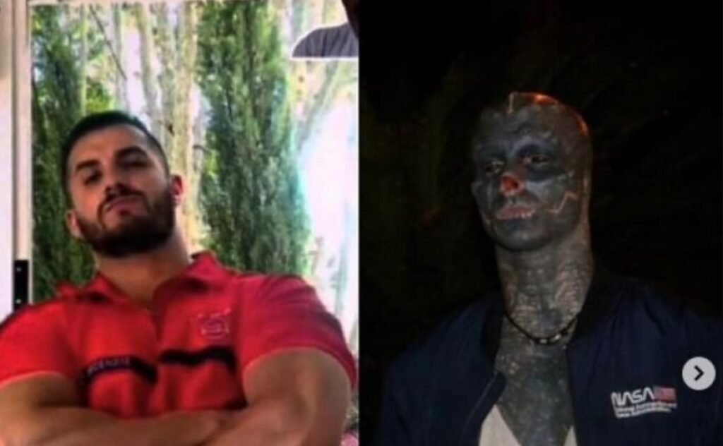 FOTO// Şi-a tăiat nasul şi degetele ca să arate ca un extraterestru. Povestea bărbatului care nu a mai vrut să fie om