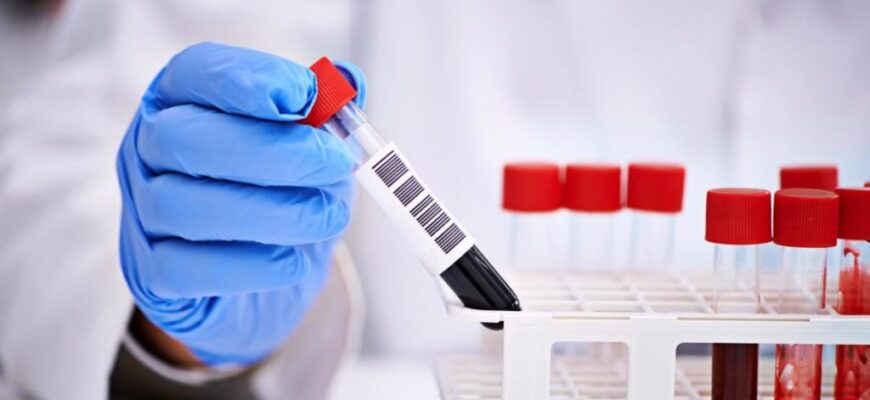 5bb3cf317a099d67116c426a 5bf6707ce4d96 1024x683 1