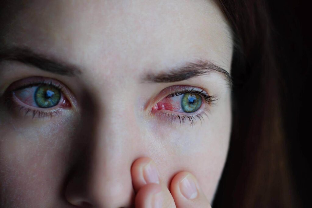 ochi rosii dupa somn cand este periculos