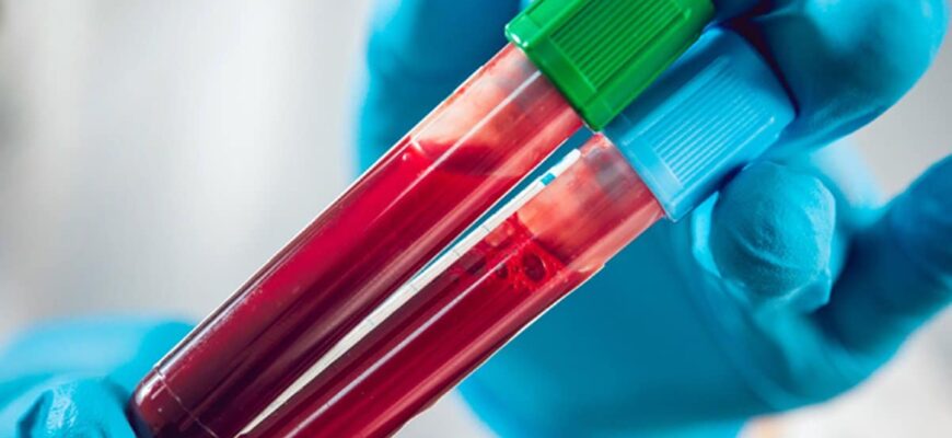 teste de sange