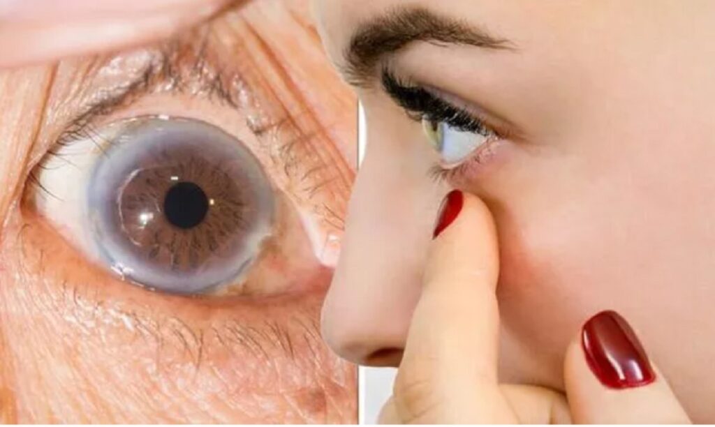 tratament revolutionar pentru glaucom