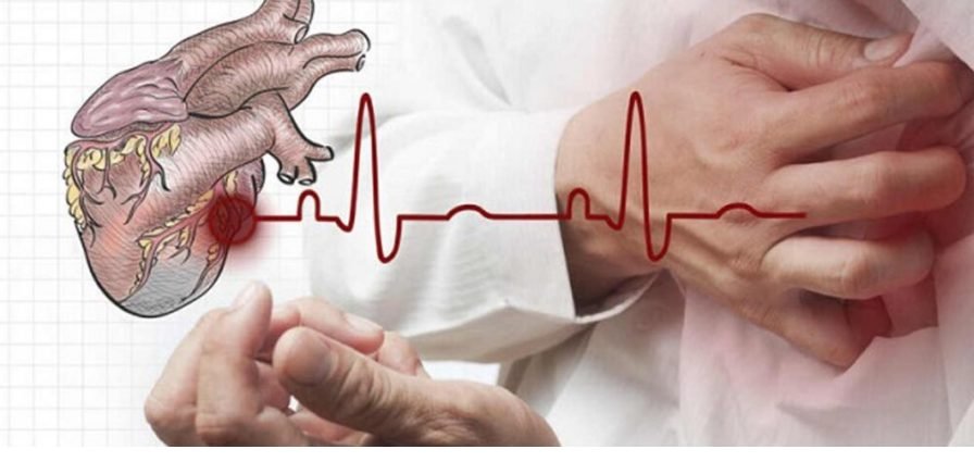 Dieta care protejează împotriva atacului de cord și a accidentului vascular cerebral 1 Dieta care protejează împotriva atacului de cord și a accidentului vascular cerebral