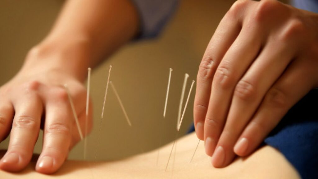 efectele acupuncturii pentru organism