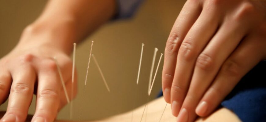 efectele acupuncturii pentru organism