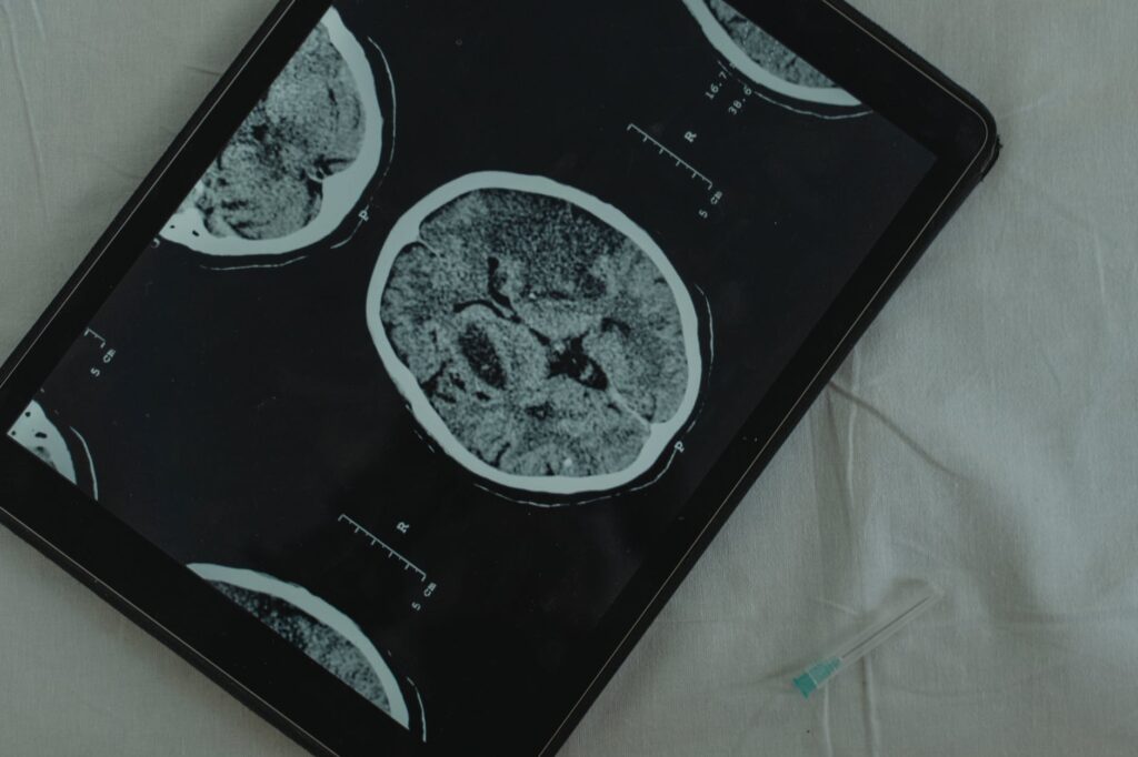 Obiceiuri care dăunează creierului. La ce să renunți înainte să îți distrugi mintea 1 brain image on digital tablet