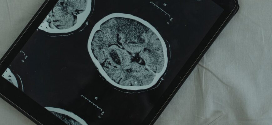 brain image on digital tablet