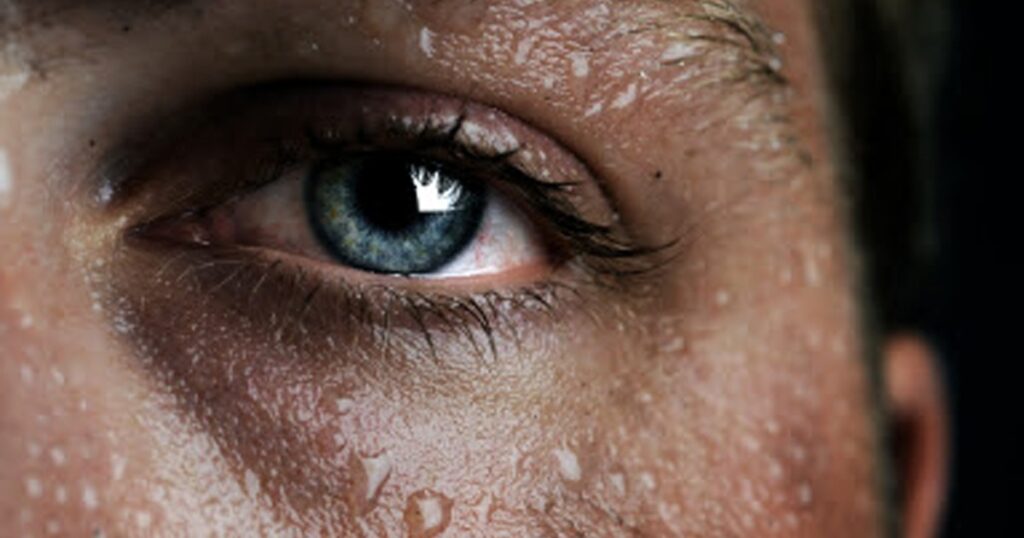 transpiratie excesiva