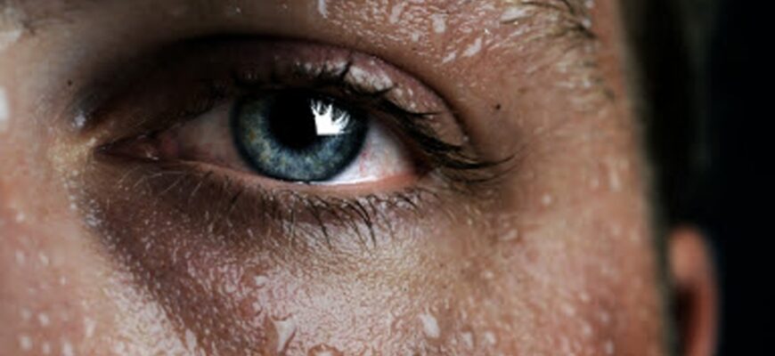 transpiratie excesiva