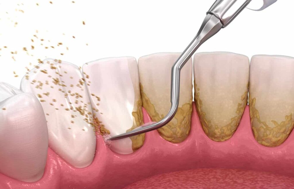 tratamente naturiste