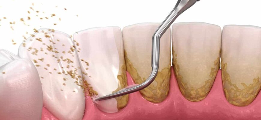 tratamente naturiste