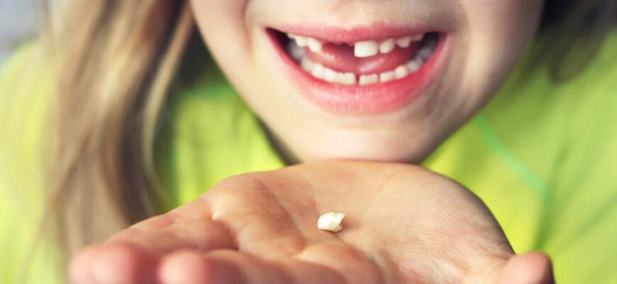 ai ramas fara unul sau mai multi dinti