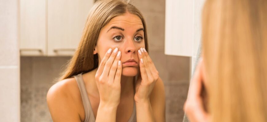 ochi umflati dimineata