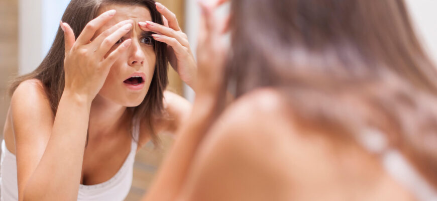 pielea cu tendinta la acnee