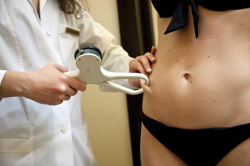 tesutul adipos sau grasimea corporala