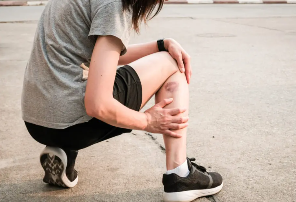 cele mai comune cauze ale vanatailor