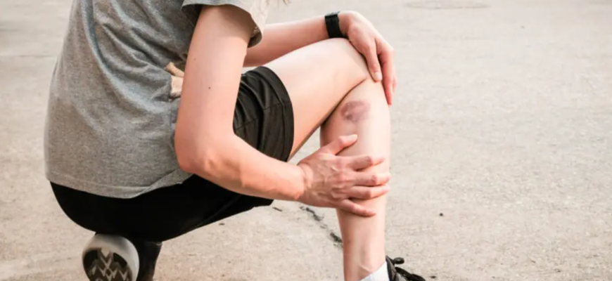 cele mai comune cauze ale vanatailor