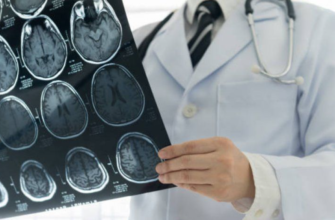 Celule din creier care provoacă răul de mişcare, identificate într-un studiu preclinic 2 celule din creier care provoaca raul de miscare