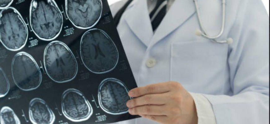 Celule din creier care provoacă răul de mişcare, identificate într-un studiu preclinic 1 celule din creier care provoaca raul de miscare