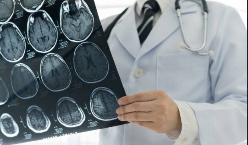 Celule din creier care provoacă răul de mişcare, identificate într-un studiu preclinic