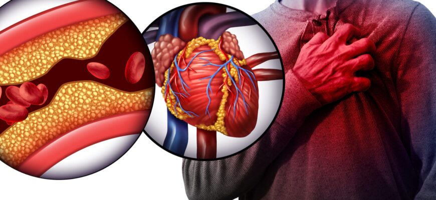 cum iti afecteaza colesterolul sanatatea