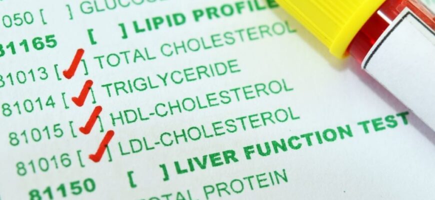 nivelul crescut de trigliceride