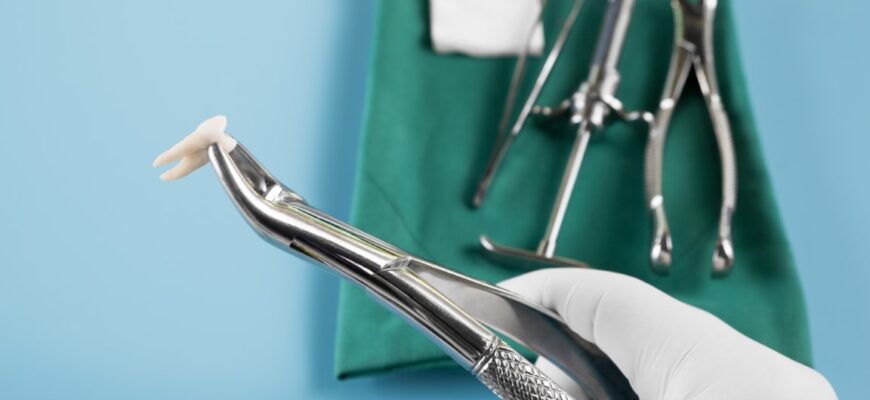 sangerare dupa extractia dentara