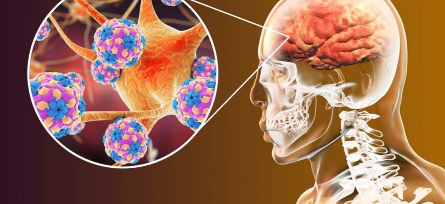 simptomele provocate de meningita