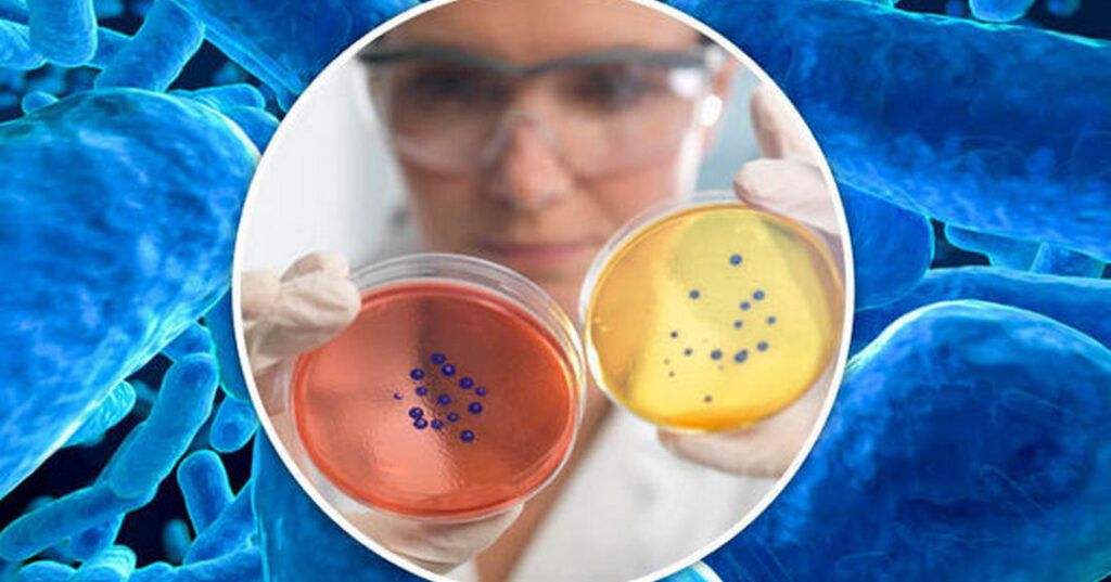 stafilococul auriu lat. staphylococcus aureus