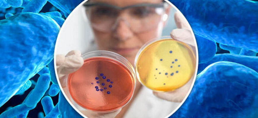 stafilococul auriu lat. staphylococcus aureus