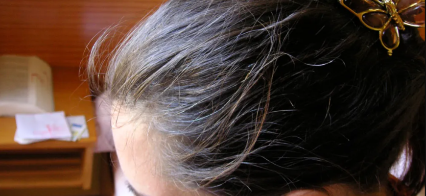 aparitia parului alb poate fi incetinita sau stopata. solutii si remedii naturale