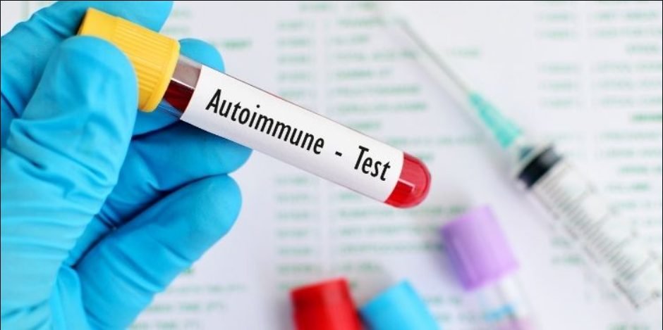 Simptomele frecvente ale bolilor autoimune și cauzele care le declanșează