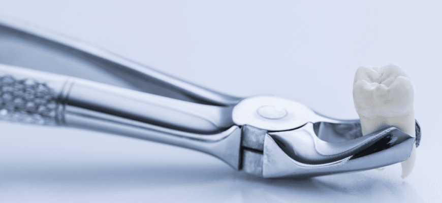 ce sunt maselele de minte