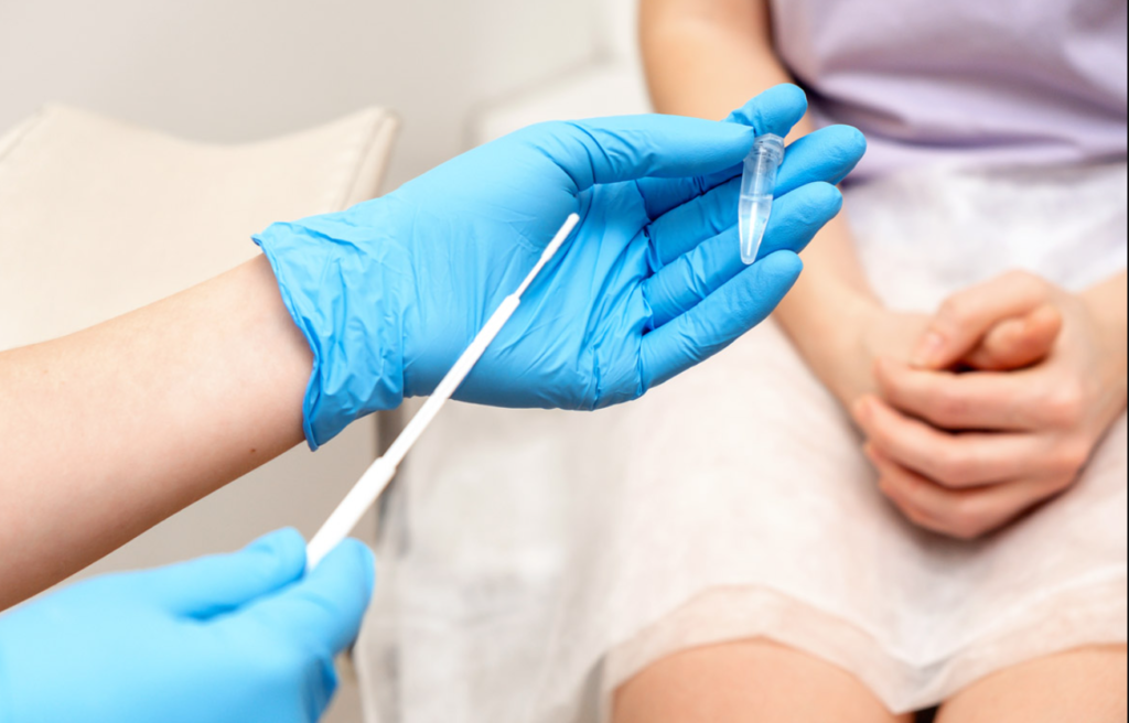 infectia cu chlamydia